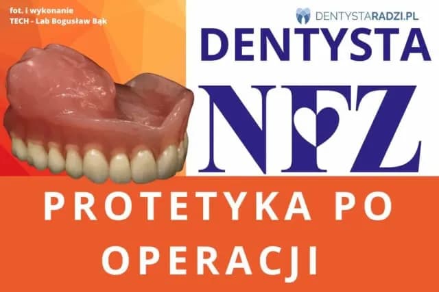 Gdzie zrobić protezę zębową na NFZ i uniknąć długiego czekania Gdzie zrobić protezę zębową na NFZ i uniknąć długiego czekania